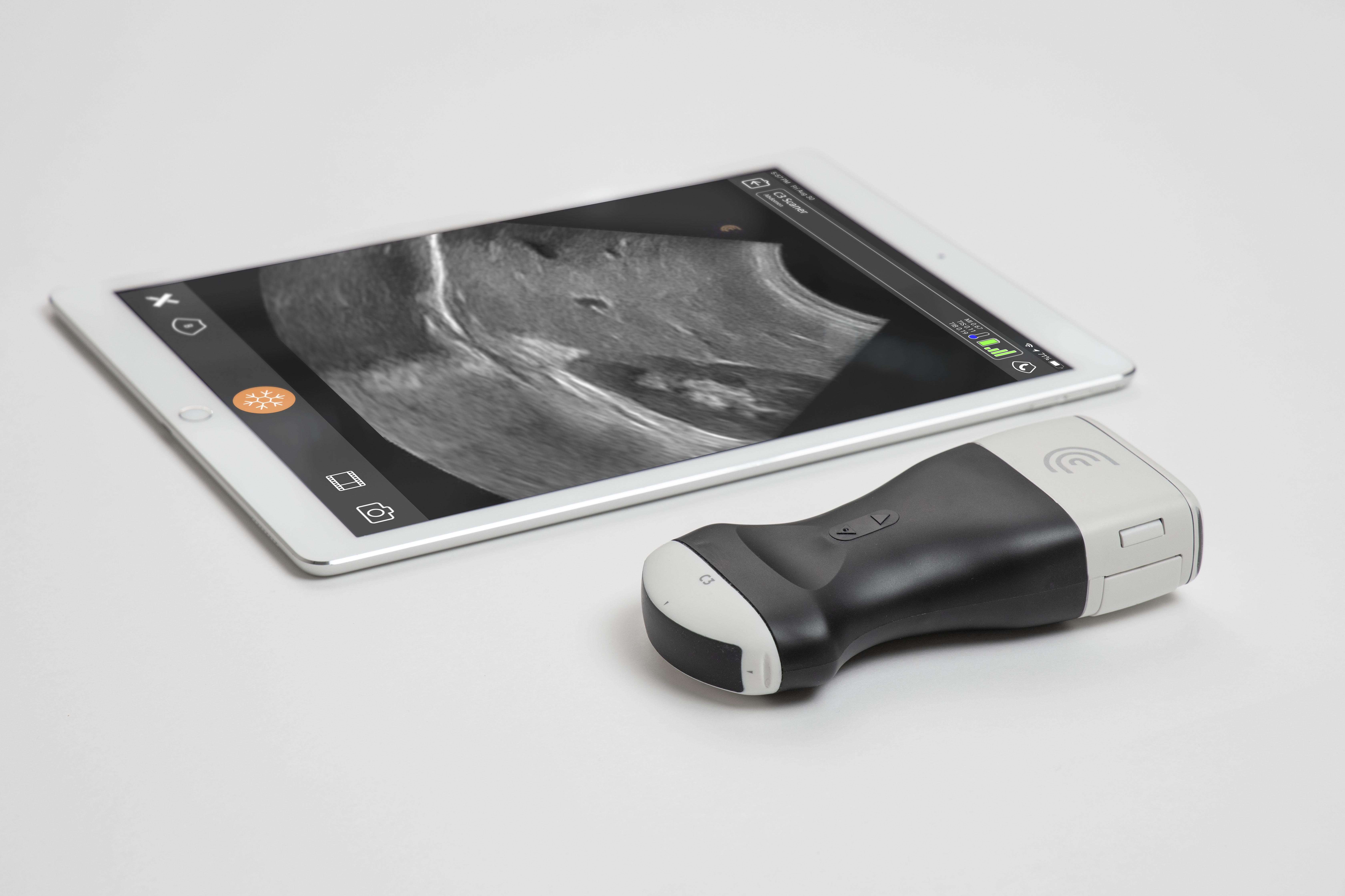 Clarius – Ultra-portable ultrasound scanners Built with Qt